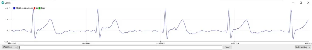 gebrabit-ads1194-signal